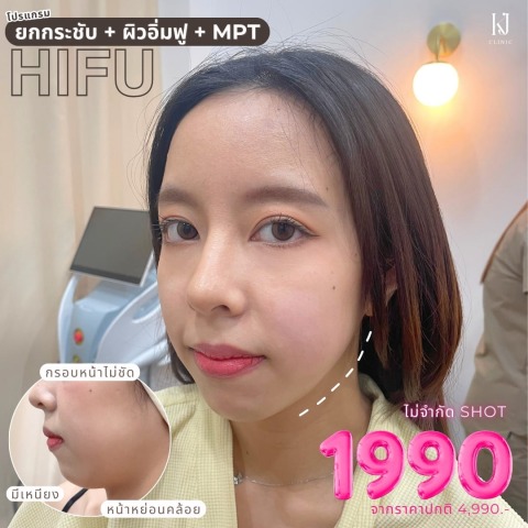 Hifu อินทามระ